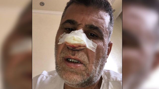 Antepspor Eski Başkanı Şahin Hastaneye Kaldırıldı